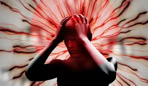 Possible novel migraine therapy