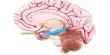 Sleep-induced Deep-brain Stimulation improves Memory