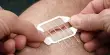 Smart Stitches have the potential to Minimize Infection and Simplify Post-operative Monitoring