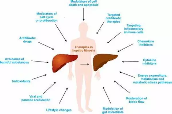 Hormones have the potential to treat liver fibrosis