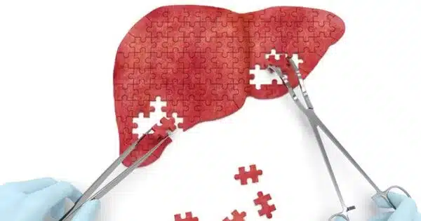 Hormones may be Useful in Treating Liver Fibrosis