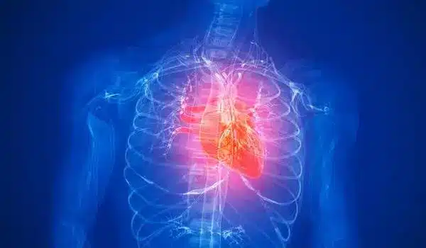 Semaglutide reduced cardiovascular events by 20% in certain adults