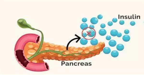 Insulin Resistance has been linked to Pancreatic Cancer