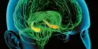 Trauma-related Brain Activity causes Distinct Brain Activity