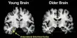 How Aging Affects Brain Cells’ Ability to Retain Memory