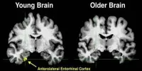How Aging Affects Brain Cells’ Ability to Retain Memory