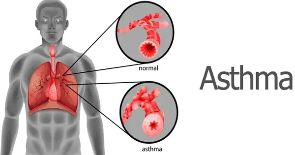 In Elderly Men, specialized T Cells may cause Severe Asthma Attacks
